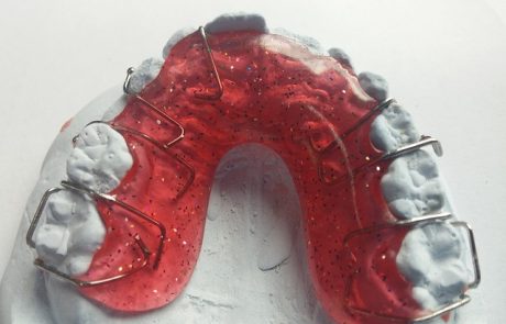 איך לשמור על בריאות השיניים בגיל השלישי? 